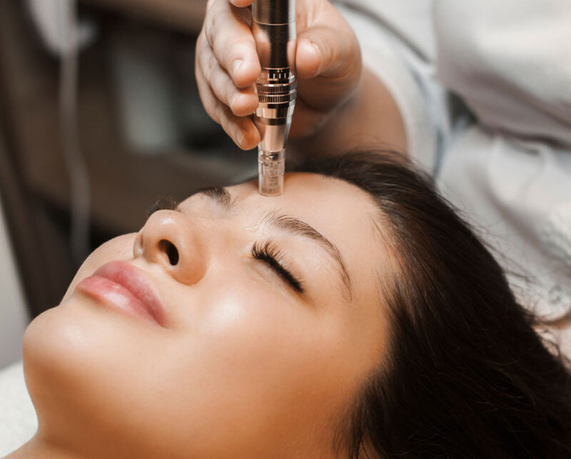 Tratamiento microneedling, Dermapen